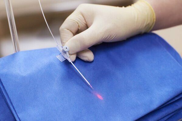 In some cases, laser therapy is used for chronic prostatitis. 