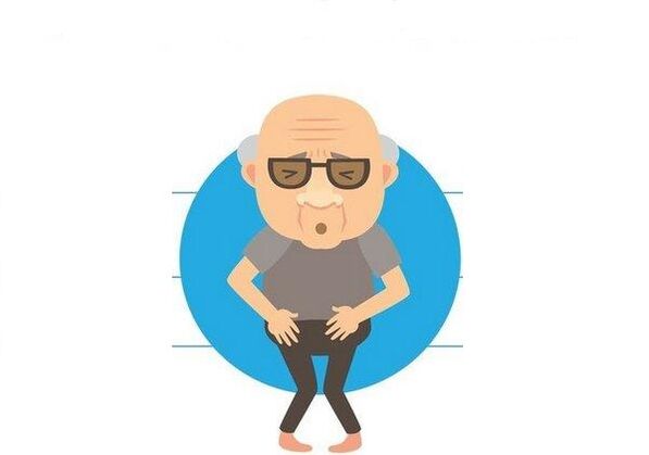 Prostatitis signs