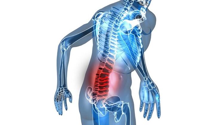 Inflammation with congestive prostatitis.